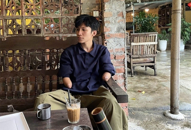 T&igrave;nh y&ecirc;u cuộc sống của ch&agrave;ng trai mồ c&ocirc;i mất cả 2 tay - Ảnh 1.