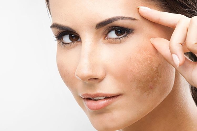 Tầm quan trọng của chống nắng đúng cách - Ảnh 2.