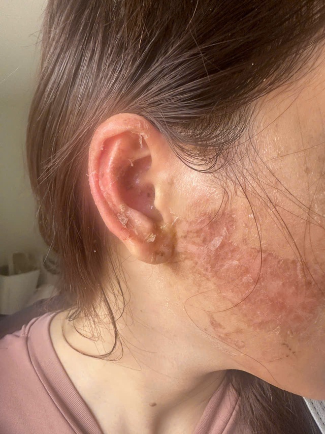 Cà Mau: Một phụ nữ tố bị bắt, đánh đập, xăm mặt, tạt axit vì ghen- Ảnh 2.