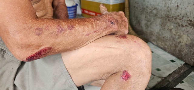 Phẫn nộ clip kẻ trộm chim khiến người đ&agrave;n &ocirc;ng 67 tuổi t&eacute; ng&atilde; khi truy đuổi- Ảnh 2.