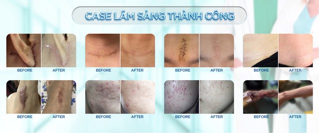 Plasma Gold: Bước tiến khoa học mới trong hành trình điều trị da- Ảnh 3.