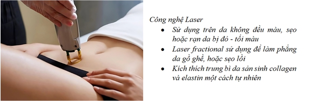 Rạn da sau sinh và hành trình tìm lại sự tự tin - Ảnh 7. Rạn da sau sinh và hành trình tìm lại sự tự tin - Ảnh 7.