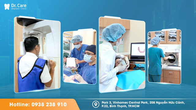 Trồng implant tuổi trung niên, chọn sức khỏe hay chi phí rẻ? - Ảnh 4.