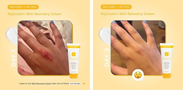 Bật mí các bước skincare buổi tối cùng Rejuvaskin: Da bật tone, căng mịn sau 7 ngày- Ảnh 9. Bật mí các bước skincare buổi tối cùng Rejuvaskin: Da bật tone, căng mịn sau 7 ngày- Ảnh 9.