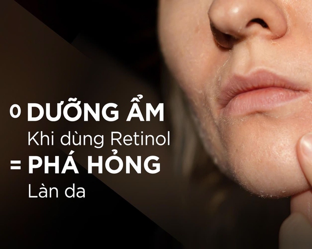 Không dưỡng ẩm khi dùng retinol = ‘phá hỏng’ công trình chăm sóc da- Ảnh 1.