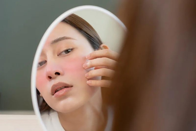 Không dưỡng ẩm khi dùng retinol = ‘phá hỏng’ công trình chăm sóc da- Ảnh 2.