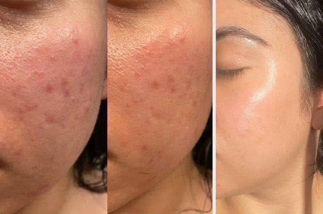 2025 rồi, U.30 mà bỏ qua 4 hoạt chất này thì hỏi sao da già trước tuổi!- Ảnh 3.