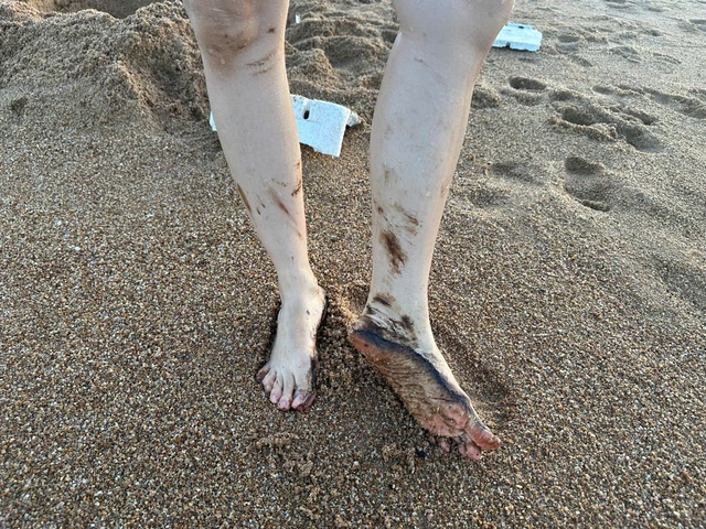 Chằng chịt vết dầu đen tấp v&agrave;o b&atilde;i biển Tuy H&ograve;a - Ảnh 2.