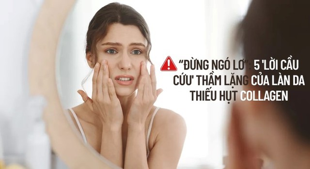 Đừng ngó lơ: 5 ‘Lời cầu cứu’ thầm lặng của làn da thiếu hụt collagen Đừng ngó lơ: 5 ‘Lời cầu cứu’ thầm lặng của làn da thiếu hụt collagen