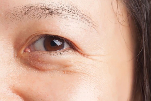 Đừng ngó lơ: 5 'Lời cầu cứu' thầm lặng của làn da thiếu hụt collagen- Ảnh 2. Đừng ngó lơ: 5 'Lời cầu cứu' thầm lặng của làn da thiếu hụt collagen- Ảnh 2.
