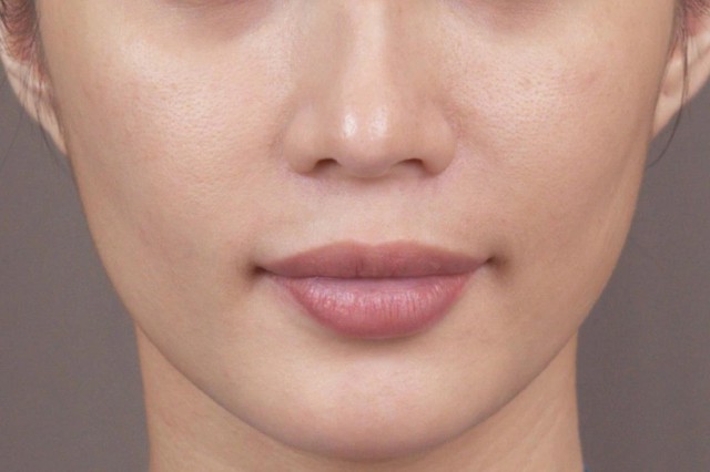 Đừng ngó lơ: 5 'Lời cầu cứu' thầm lặng của làn da thiếu hụt collagen- Ảnh 3. Đừng ngó lơ: 5 'Lời cầu cứu' thầm lặng của làn da thiếu hụt collagen- Ảnh 3.