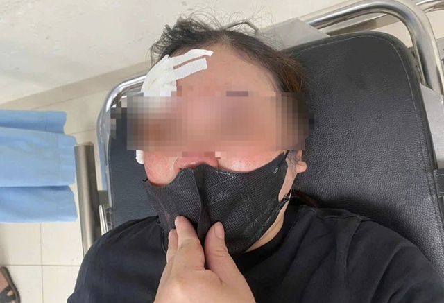 Người phụ nữ bị hành hung vì dừng xe trên đường nghe điện thoại Người phụ nữ bị hành hung vì dừng xe trên đường nghe điện thoại