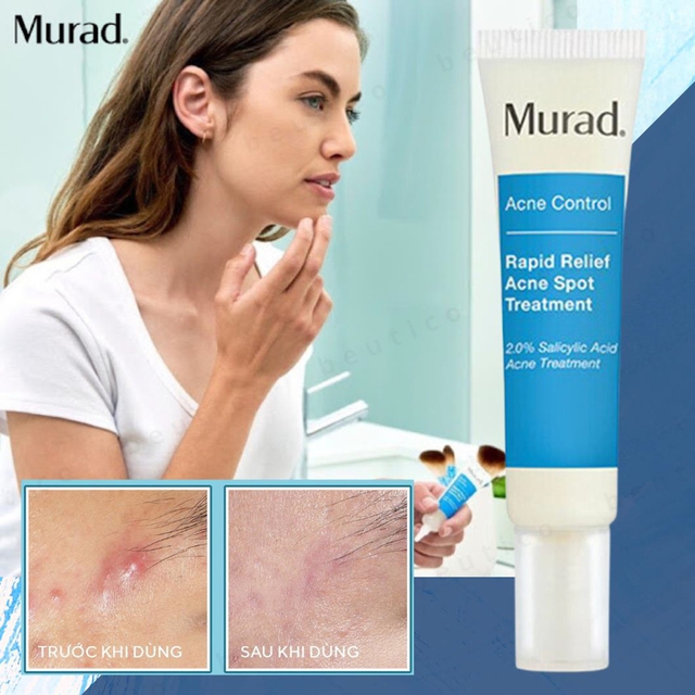 Top 12 kem trị mụn cho da dầu được gen Z, gen Alpha tìm mua nhiều - Ảnh 10.