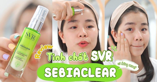 Top 12 kem trị mụn cho da dầu được gen Z, gen Alpha tìm mua nhiều - Ảnh 15.