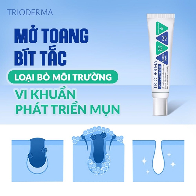 Top 12 kem trị mụn cho da dầu được gen Z, gen Alpha tìm mua nhiều - Ảnh 2.