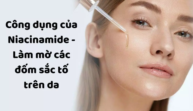 Niacinamide là gì? 'Power ingredient' đa năng – Càng dùng da càng trắng sáng, khỏe đẹp? - Ảnh 3.