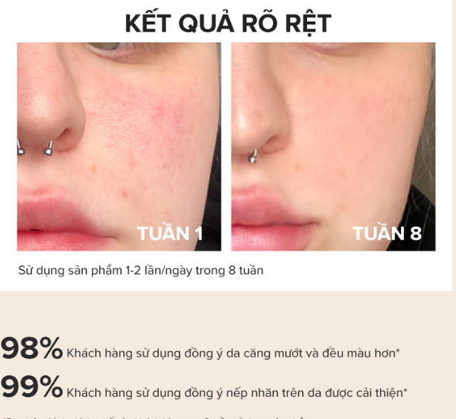 +3 serum "bơm nước" da căng bóng như tiêm Skin Booster không thể thiếu trong mùa hè - Ảnh 5.