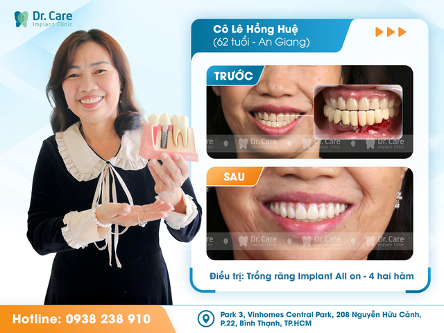 Gần một thập kỷ chuyên sâu trồng Implant - Dr. Care chọn lối đi riêng- Ảnh 3. Gần một thập kỷ chuyên sâu trồng Implant - Dr. Care chọn lối đi riêng- Ảnh 3.