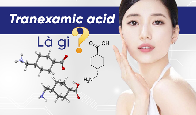Tranexamic Acid là gì? Có thật sự làm mờ thâm nám da trắng sáng rạng rỡ? Tranexamic Acid là gì? Có thật sự làm mờ thâm nám da trắng sáng rạng rỡ?