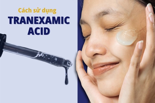 Tranexamic Acid là gì? Có thật sự làm mờ thâm nám da trắng sáng rạng rỡ? - Ảnh 5.