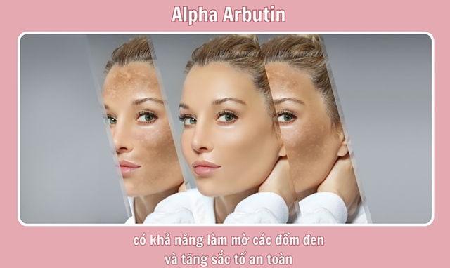 Arbutin là gì? Tác dụng đối với làn da và top 3 được tìm mua nhiều - Ảnh 5.