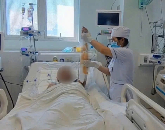 Thoát 'cửa tử' nhờ điều trị kịp thời viêm mô bào biến chứng suy đa tạng - Ảnh 1.