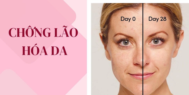 Retinol là gì? 5 tác dụng cho làn da tươi trẻ và cách dùng không kích ứng - Ảnh 3.