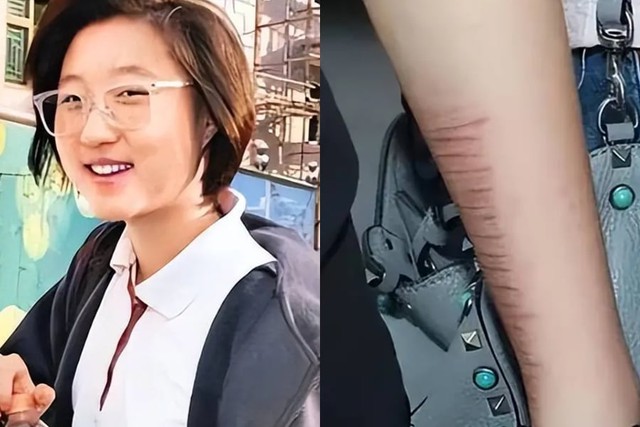 Bi kịch chưa hồi kết của Ngô Trác Lâm con gái Thành Long - Ảnh 2.