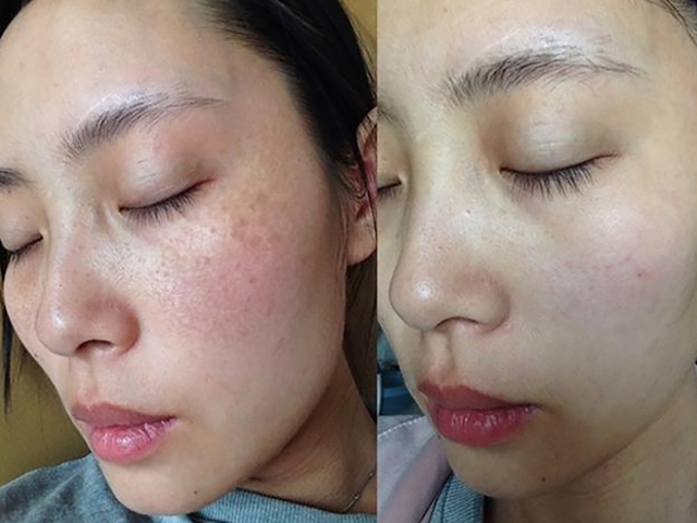 Top 10 serum trị nám lâu năm, da sạm cỡ nào cũng bật tone trắng hồng- Ảnh 13.