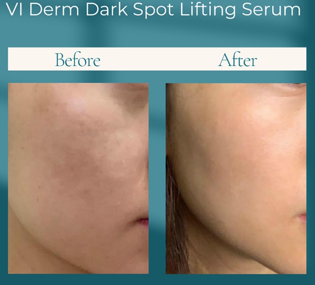 Top 10 serum trị nám lâu năm, da sạm cỡ nào cũng bật tone trắng hồng- Ảnh 3.