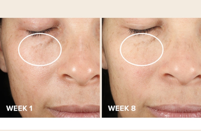 Top 10 serum trị nám lâu năm, da sạm cỡ nào cũng bật tone trắng hồng- Ảnh 5.