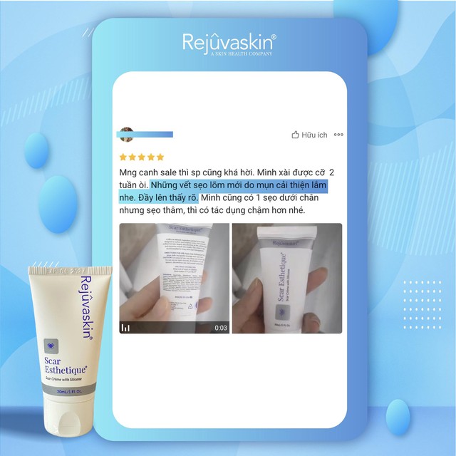 Scar Esthetique: 'Gỡ rối' sẹo rỗ đỏ sau mụn - B&iacute; quyết từ chuy&ecirc;n gia- Ảnh 4.