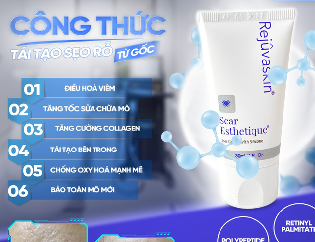Từ tự ti đến tự tin: Scar Esthetique đang đồng hành cùng làn da Gen Z - Ảnh 2.