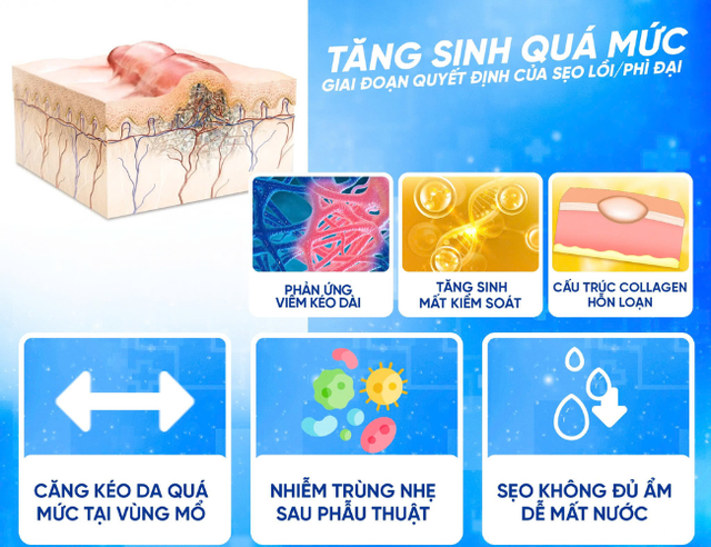 Bí quyết chọn kem trị sẹo sau phẫu thuật: Làm sao để đạt hiệu quả tối ưu? Bí quyết chọn kem trị sẹo sau phẫu thuật: Làm sao để đạt hiệu quả tối ưu?