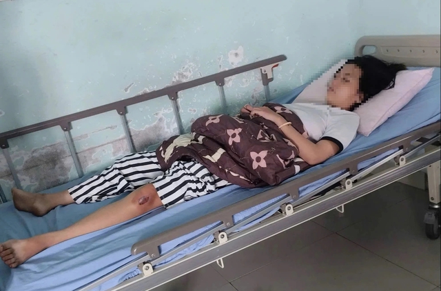 Vụ người mẹ trẻ 19 tuổi bị đánh hội đồng vì 'nhìn thấy ghét' - Ảnh 2.