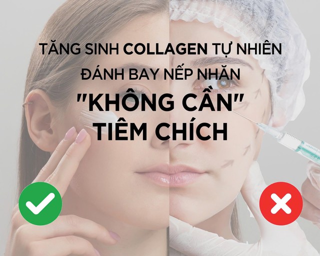 Tăng sinh collagen tự nhiên, đánh bay nếp nhăn không cần tiêm chích Tăng sinh collagen tự nhiên, đánh bay nếp nhăn không cần tiêm chích