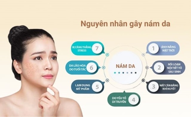 Gợi ý cách trị nám chân sâu, nám mảng... hiệu quả tại nhà không cần xâm lấn- Ảnh 3. Gợi ý cách trị nám chân sâu, nám mảng... hiệu quả tại nhà không cần xâm lấn- Ảnh 3.