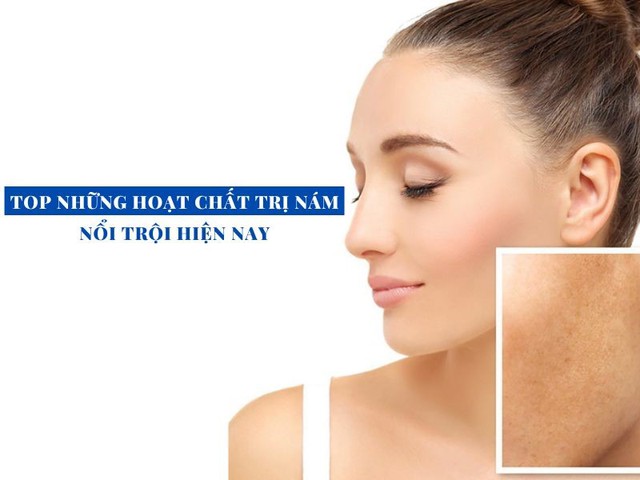 Gợi ý cách trị nám chân sâu, nám mảng... hiệu quả tại nhà không cần xâm lấn- Ảnh 5. Gợi ý cách trị nám chân sâu, nám mảng... hiệu quả tại nhà không cần xâm lấn- Ảnh 5.