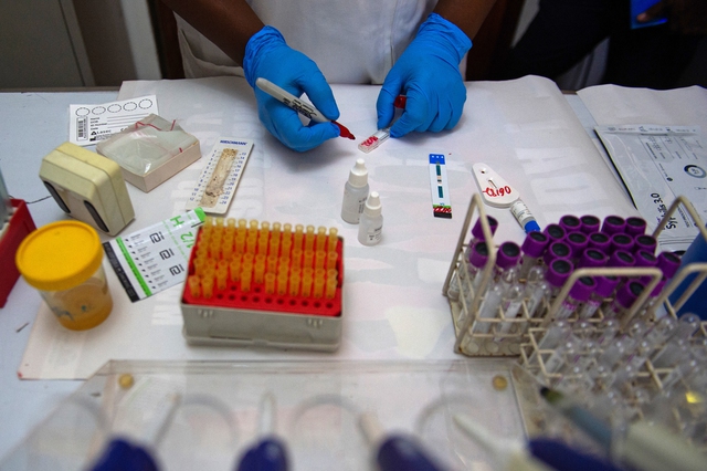 Mỹ chứng nhận thuốc ngừa HIV Yeztugo của Gilead Sciences Mỹ chứng nhận thuốc ngừa HIV Yeztugo của Gilead Sciences