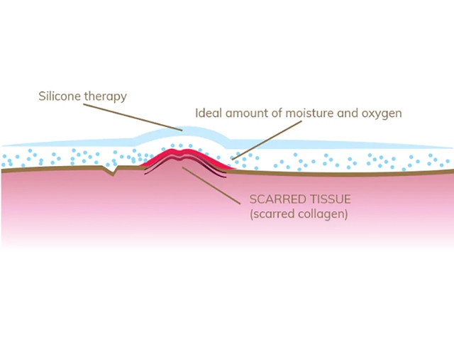 Đằng sau kết quả tạo h&igrave;nh thẩm mỹ ho&agrave;n hảo kh&ocirc;ng thể bỏ qua điều n&agrave;y - Ảnh 2.
