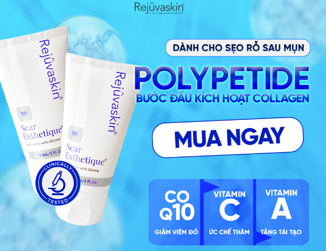 Scar Esthetique: Giải ph&aacute;p k&iacute;ch tăng sinh collagen cho sẹo l&otilde;m mịn da - Ảnh 1.