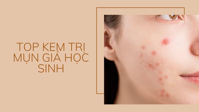 Top 5 kem trị mụn giá học sinh mà chất lượng quốc tế Top 5 kem trị mụn giá học sinh mà chất lượng quốc tế