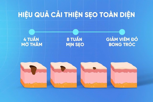 Kiến trúc làn da: ‘vật liệu’ nào giúp tái xây nền da, lấp đầy sẹo lõm? - Ảnh 2.