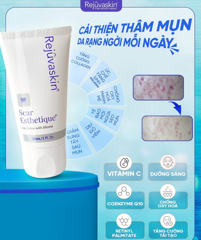 Bật mí cách trị thâm mụn hiệu quả tại nhà, kể cả thâm nặng và lâu năm Bật mí cách trị thâm mụn hiệu quả tại nhà, kể cả thâm nặng và lâu năm
