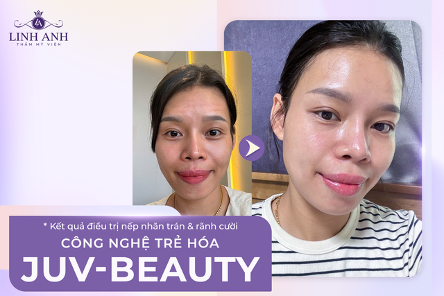 Phòng khám Thẩm mỹ Linh Anh Phú Nhuận – Đầu tư bài bản, trải nghiệm chỉn chu - Ảnh 3.