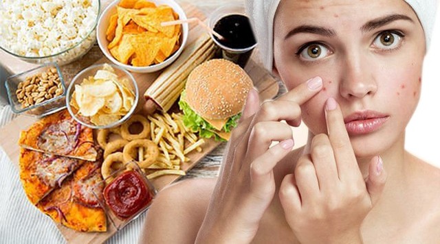 Gợi ý cách trị mụn bọc chuẩn y khoa hiệu quả tại nhà, ngăn ngừa sẹo xấu- Ảnh 4. Gợi ý cách trị mụn bọc chuẩn y khoa hiệu quả tại nhà, ngăn ngừa sẹo xấu- Ảnh 4.