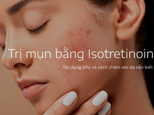 Bật mí 11 cách trị mụn nhanh, đơn giản tại nhà, ít tốn kém mà hiệu quả- Ảnh 9.