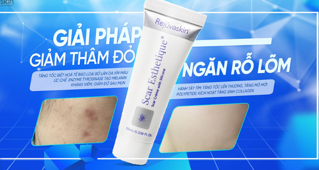 Vai trò các thành phần chống ô xy hóa trong kem trị sẹo thâm Vai trò các thành phần chống ô xy hóa trong kem trị sẹo thâm