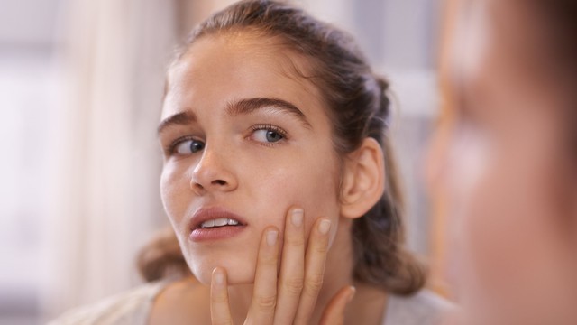 Chi tiết cách trị mụn trứng cá hiệu quả ngay tại nhà từ thể nhẹ tới nặng - Ảnh 10.