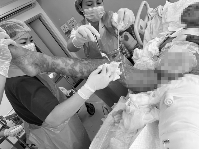 Bệnh viện Quân y 175 cứu nữ bệnh nhân bong tróc 92% da, thoát cửa tử thần Bệnh viện Quân y 175 cứu nữ bệnh nhân bong tróc 92% da, thoát cửa tử thần